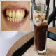 Tại Sao Răng Bị Ố Vàng? 7 Sự Thật Khiến Bạn Phải Giật Mình – Chuyên Gia Nha Khoa Tiết Lộ!
